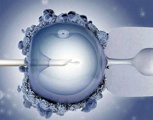 تزریق اسپرم درون سیتوپلاسم 