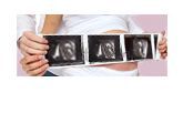 معیارهای سونوگرافی جنین در سه ماهه دوم و سوم